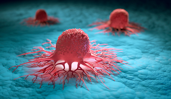 methods or ways to detect cancer earlier